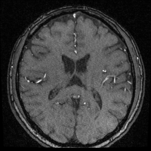 Click on the Serie image to view the images of VILLANUEVA, WILLIAM A.